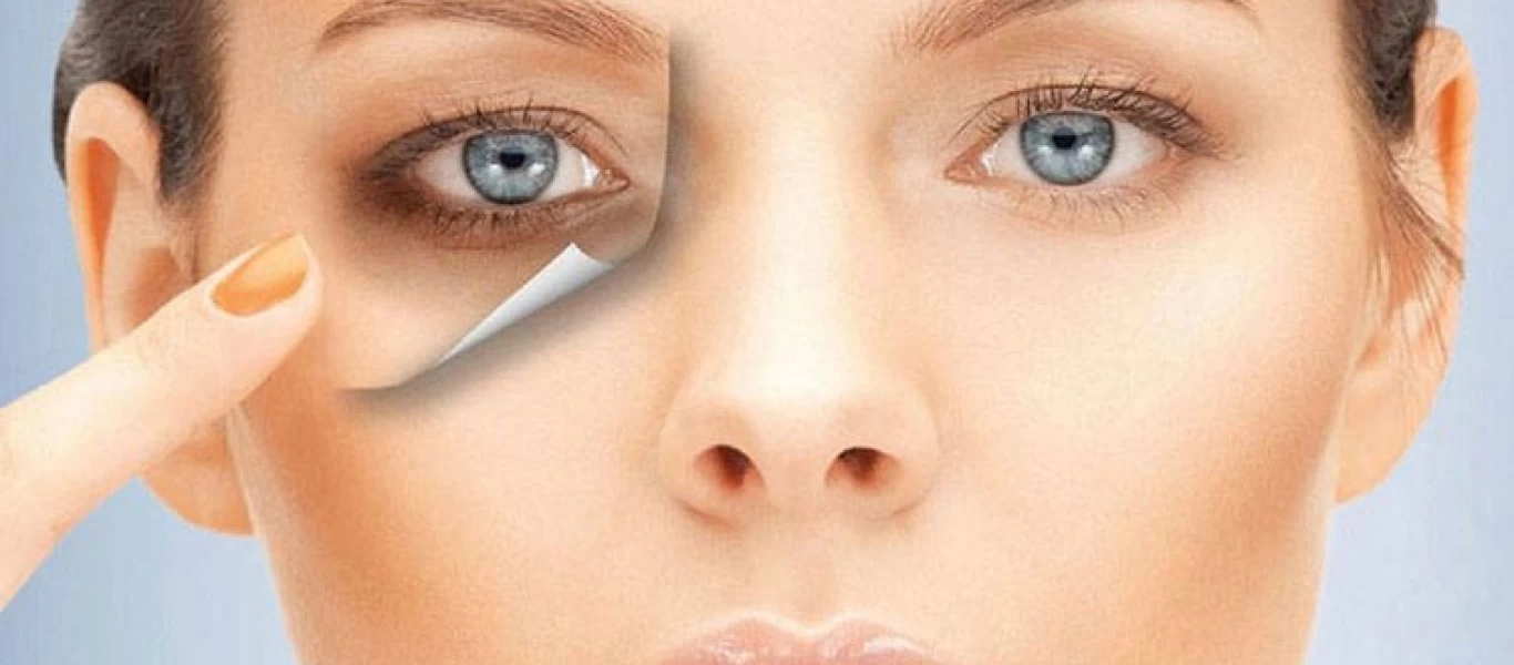 Πείτε «αντίο» στους μαύρους κύκλους με αυτό το απόλυτο γιατρικό